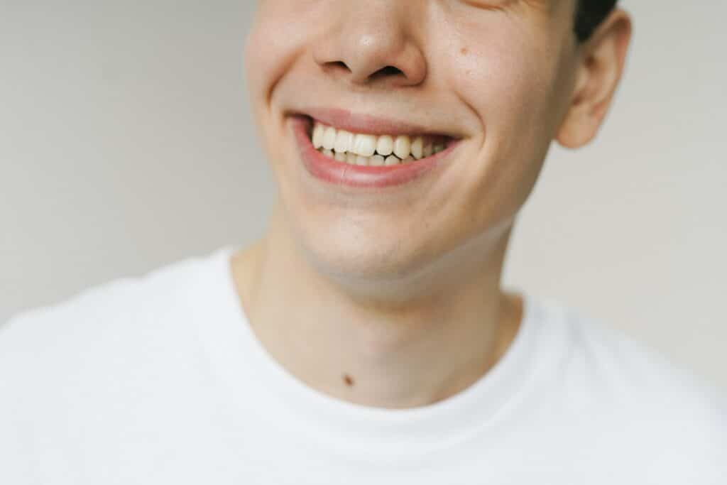 Premium dental crowns for restoring damaged teeth - expertly designed crowns for optimal function.