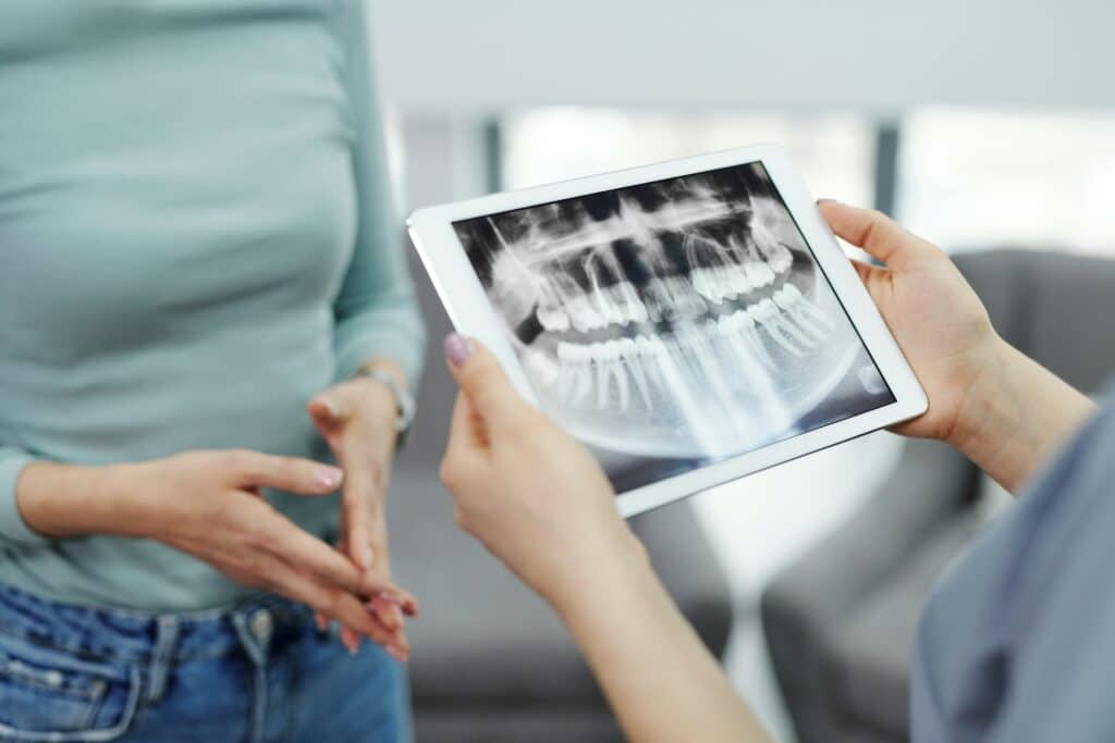 ניתוח השתלות שיניים - טכניקת שיקום שיניים מודרנית ומתקדמת.